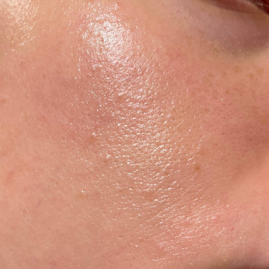 oily skin routine