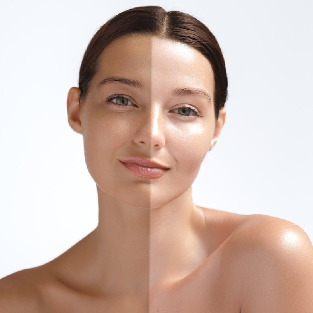 skin whitening therapy