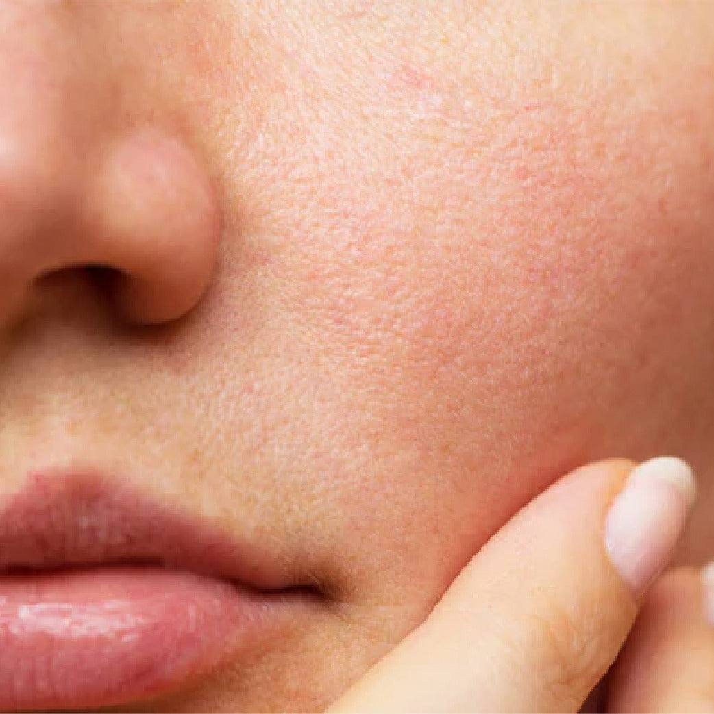 pore minimizing mask