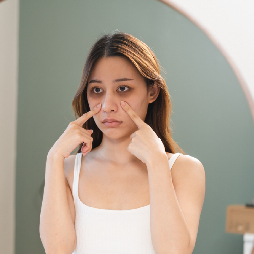 Panda eyes: The Reason for Dark Circles Under Eyes