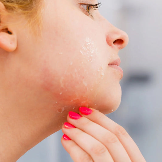 oily dehydrated skin