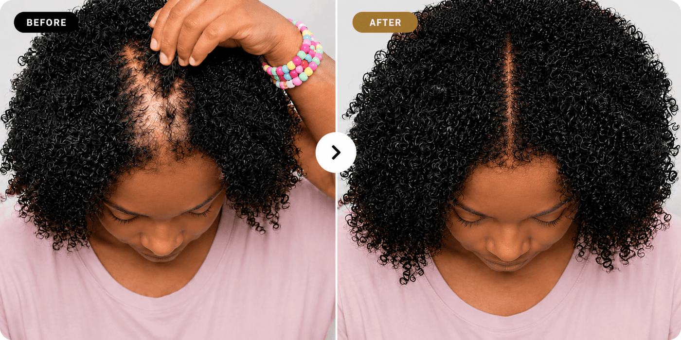 8-in-1 system before and after results